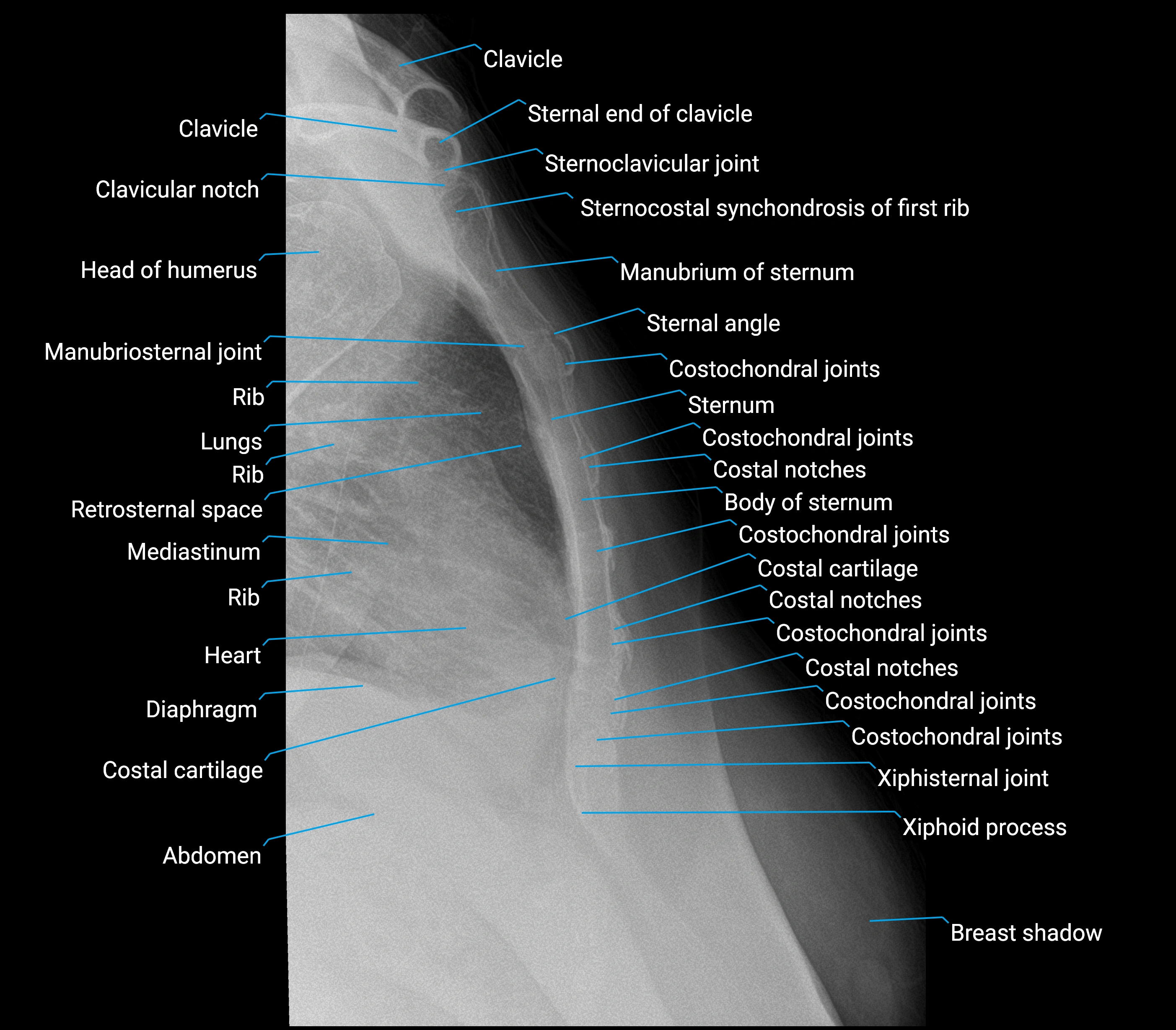 X  Ray lateral sternum view anatomy labelled image.webp